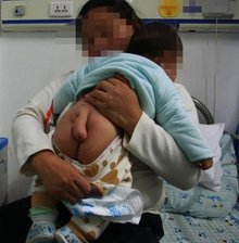尾巴男婴