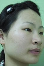 刘运奇