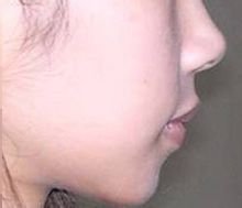 刘运奇