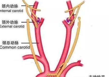 颈总动脉分叉处解剖图图片