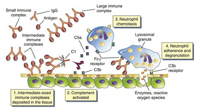 免疫复合物