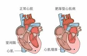 创伤性心脏骤停