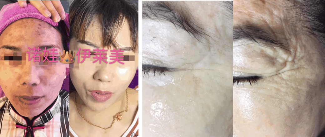 谭婧菲（伊莱美创始人）