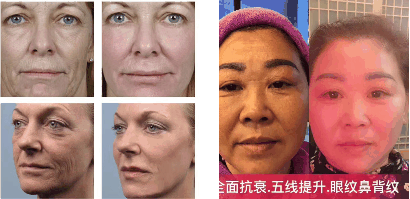 谭婧菲（伊莱美创始人）