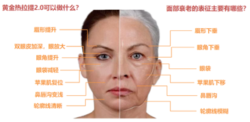 黄金热拉提|黄金热拉提超强抗衰，赶走松垂，拒绝皱纹