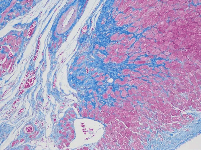 Masson三色染色法