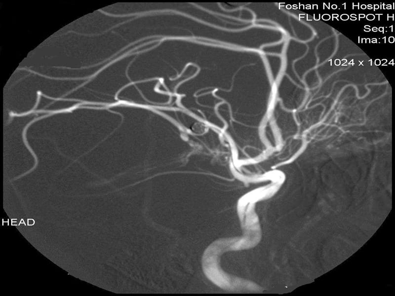功能性神经造影