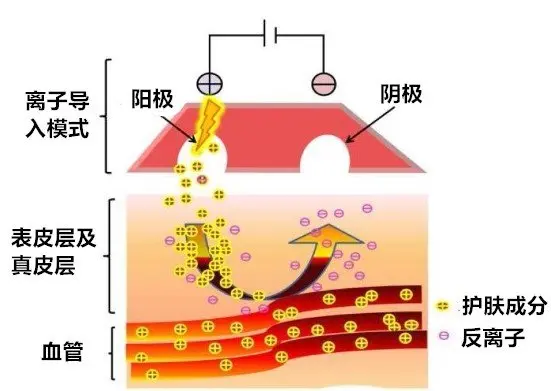 离子导入法