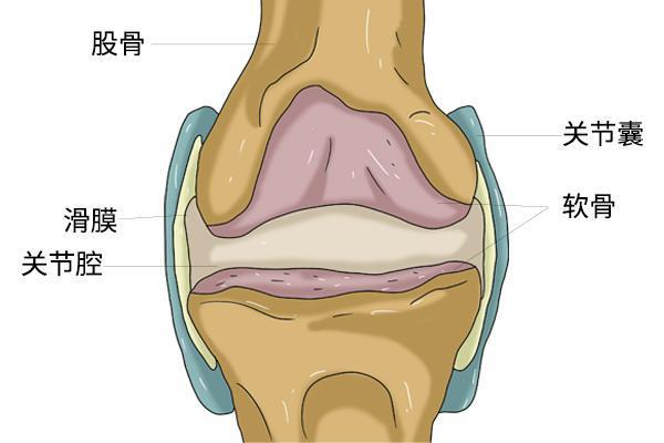 骨关节炎